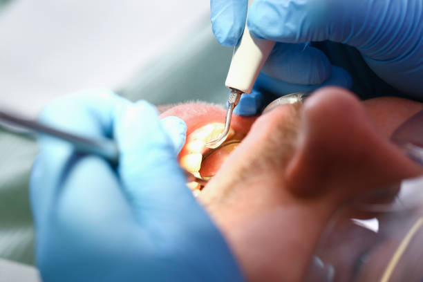 Best Emergency Tooth Extraction  in Orleans, VT